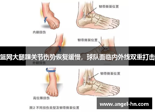 篮网大腿踝关节伤势恢复缓慢，球队面临内外线双重打击